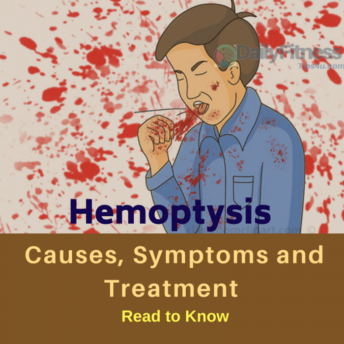 Hemoptysis: Causes, Picture, Symptoms, Treatment And Prevention