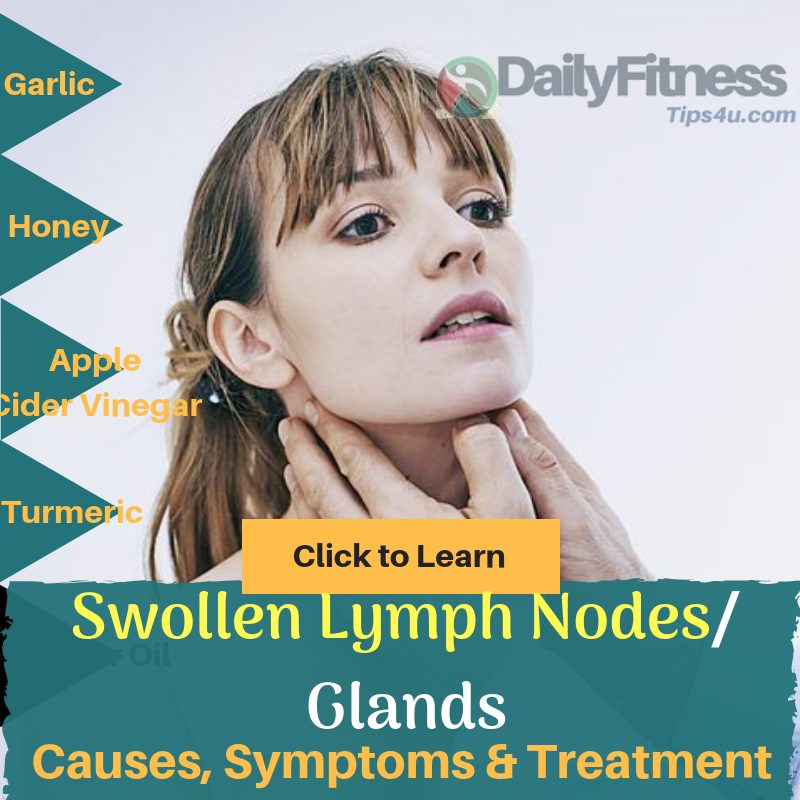 Swollen Lymph Nodes & Glands : Causes, Picture, Symptoms, Treatment